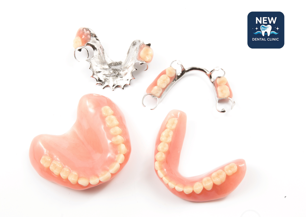 Các Loại Phổ Biến và Giải Pháp Nào Tốt Nhất