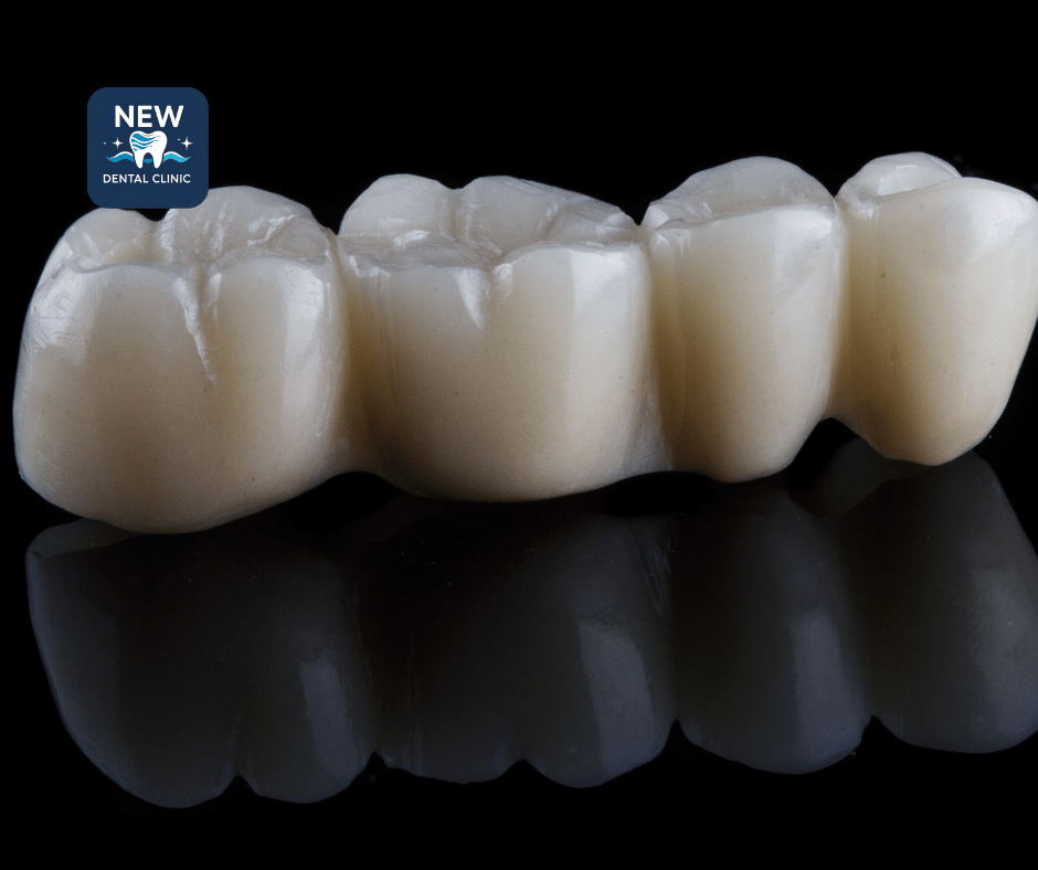 Sứ Emax (Lithium Disilicate)